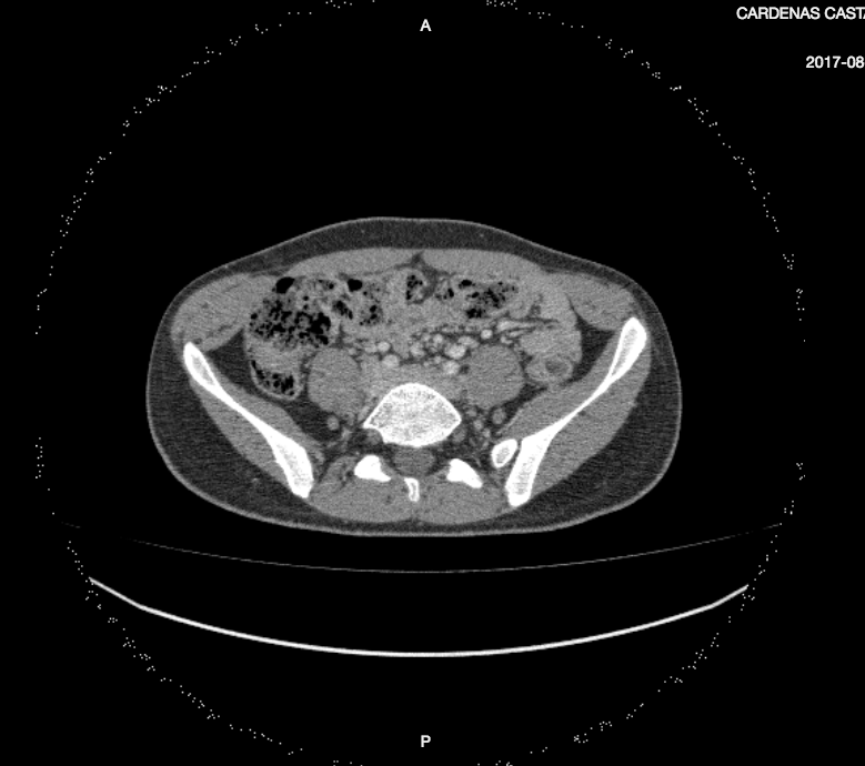 screen shot 2018-09-17 at 2 26 56 pm