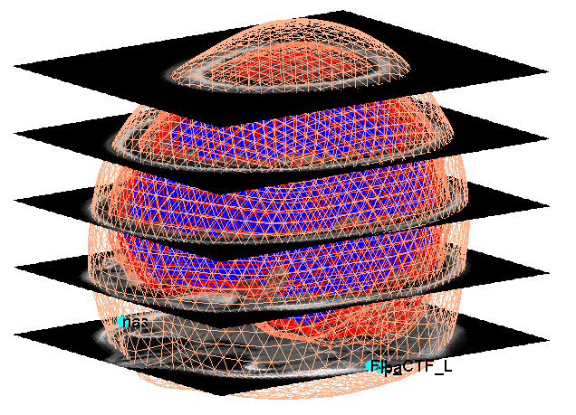 GitHub FarkadAdnan Statistical Parametric Mapping - 189548609 B40c8e1b F453 4fd5 A8a1 8e57516b1c4d 
