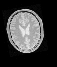 brainprotondensitytranslatedr1013x17ys12