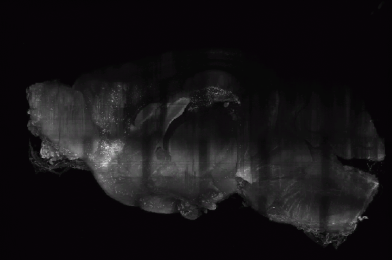 A mouse whole-brain image acquired by Confocal Light Sheet Microscopy (CLSM).