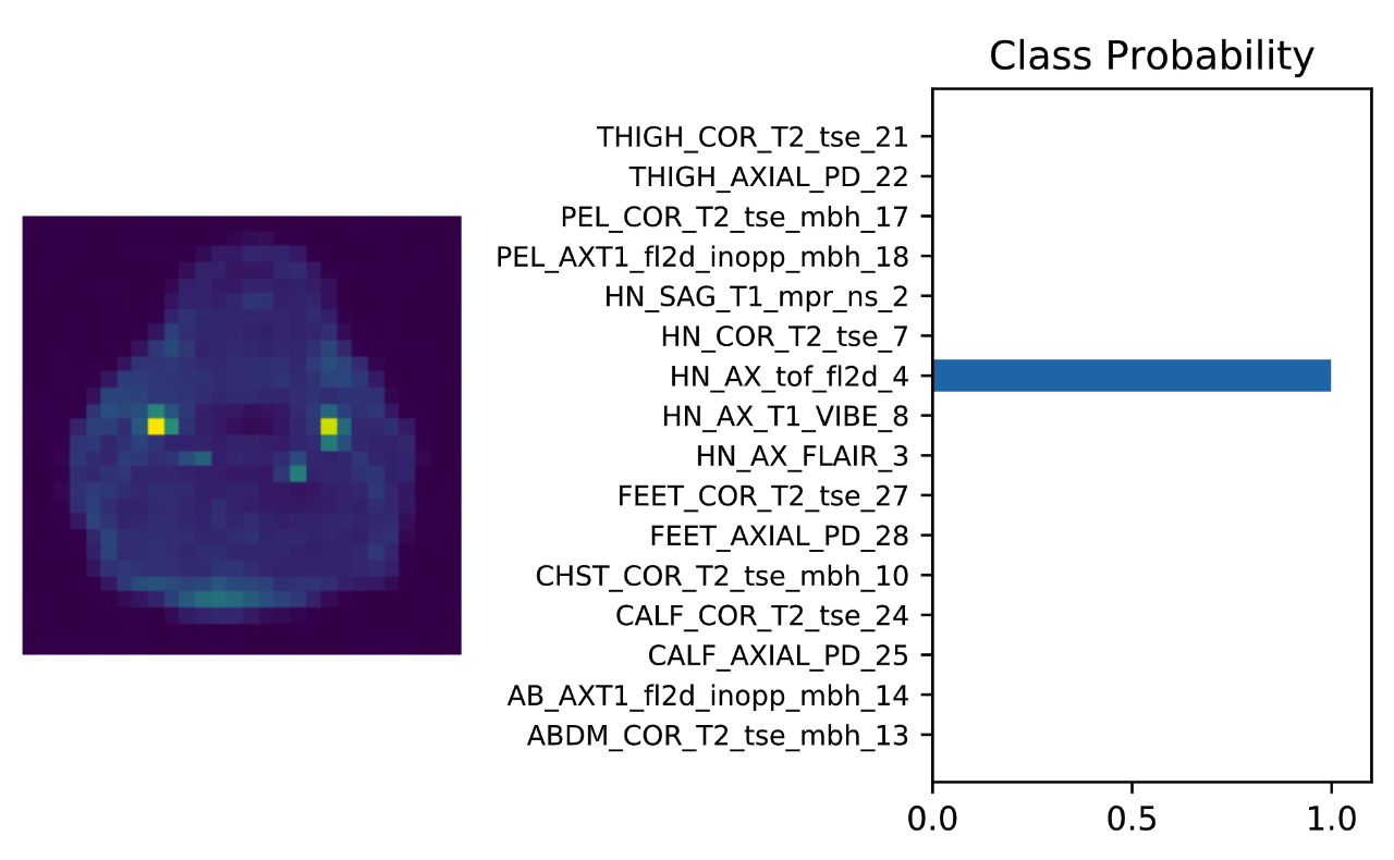 GitHub - gireeshkbogu/WBMR-Image-Classification-PyTorch: Whole-body ...