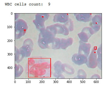 GitHub - abhishekgupta368/Analysis-and-classification-of-white-blood ...