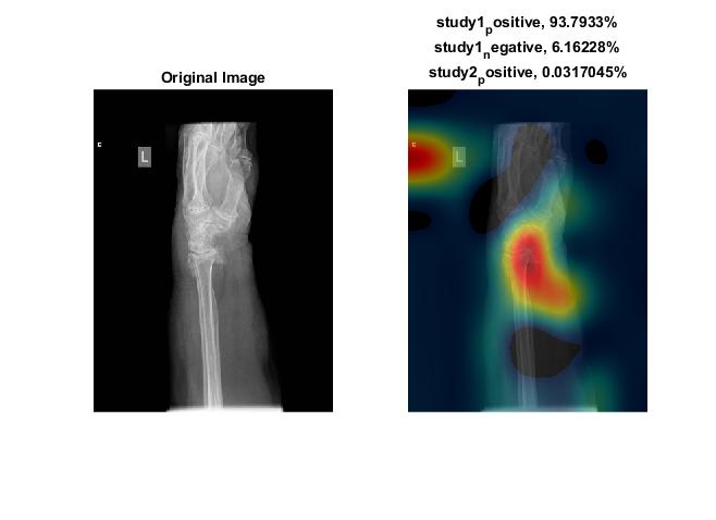 GitHub - amno/WristMatlab: Simple code for processing image using ...