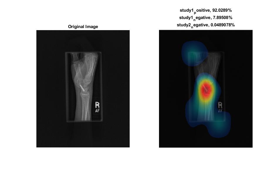 GitHub - amno/WristMatlab: Simple code for processing image using ...