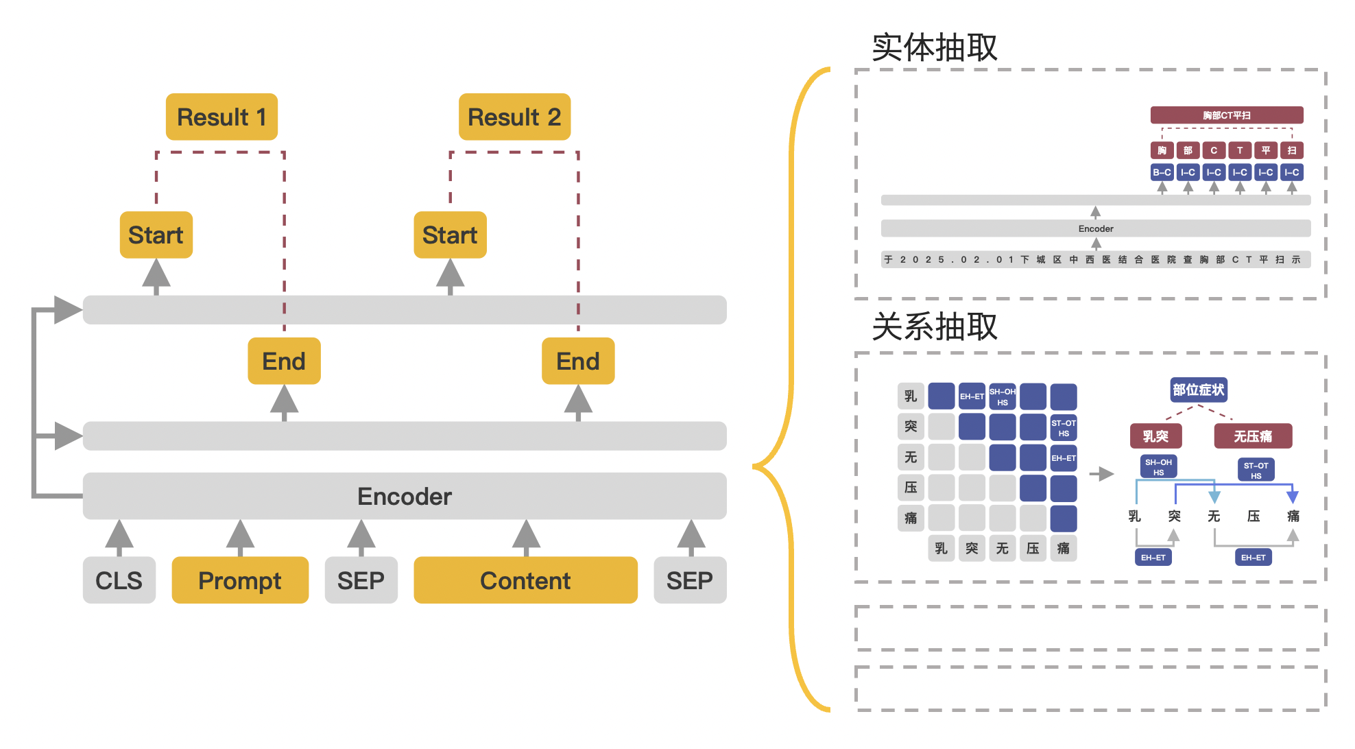 UIE-diagram