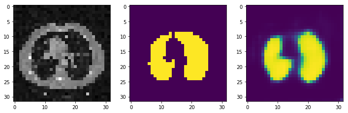 GitHub - pizzaball/LungSegmentation · GitHub
