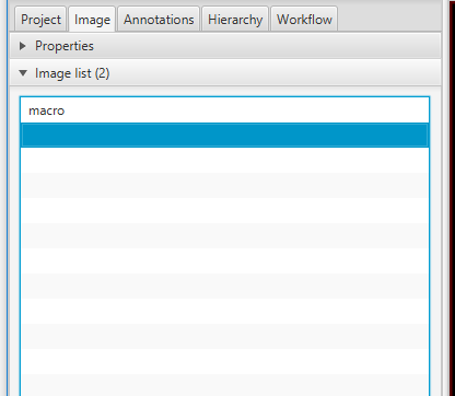 New Computer having trouble opening .scn files using Bioformats ...