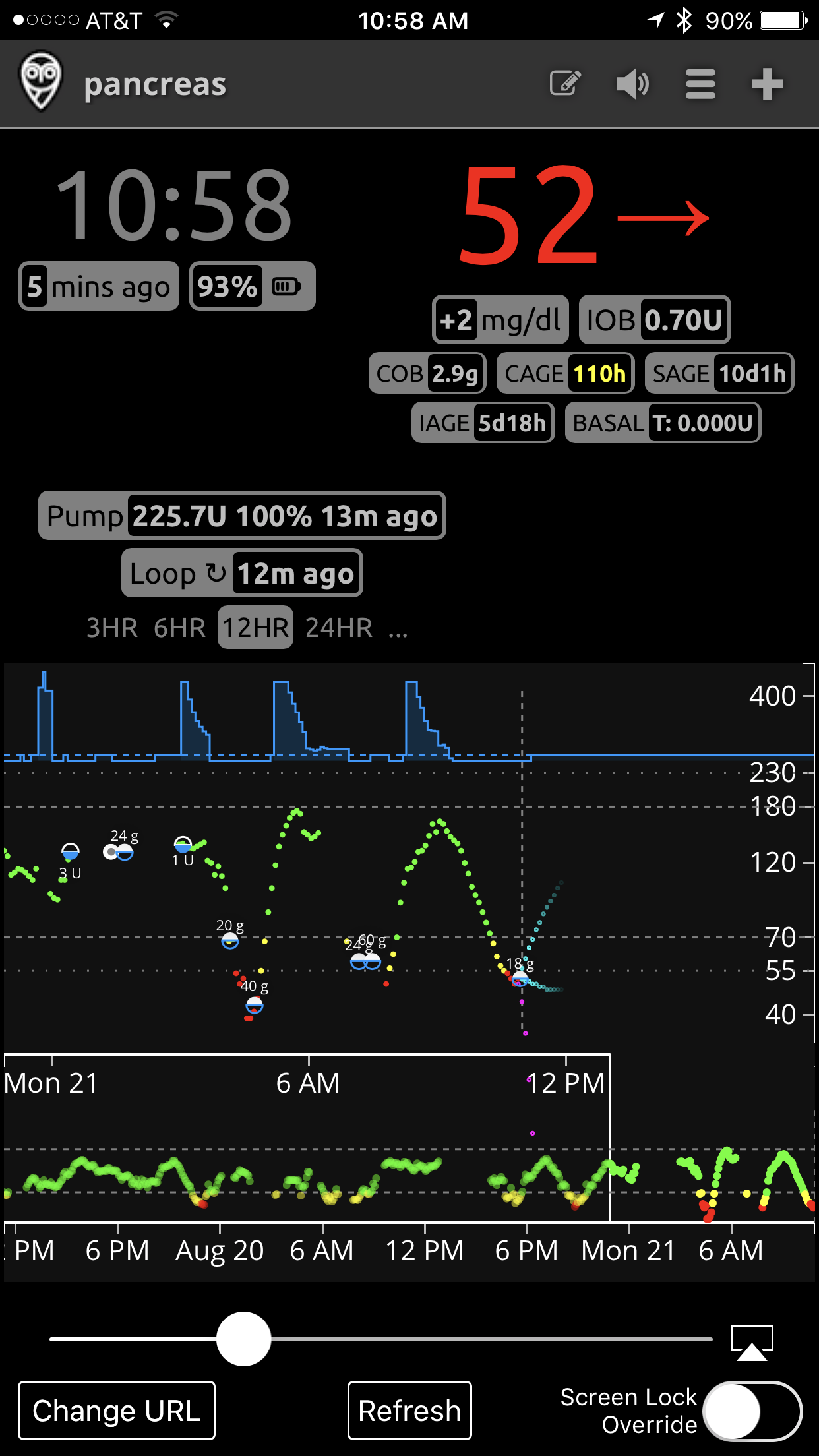 Dynamic ISF adjustments · Issue #431 · LoopKit/Loop · GitHub