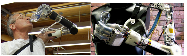deka bionic arm