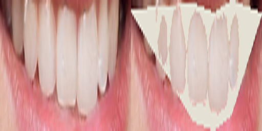 GitHub - vutuanhai237/CreateTeeth2Dataset: Script Python that converts ...