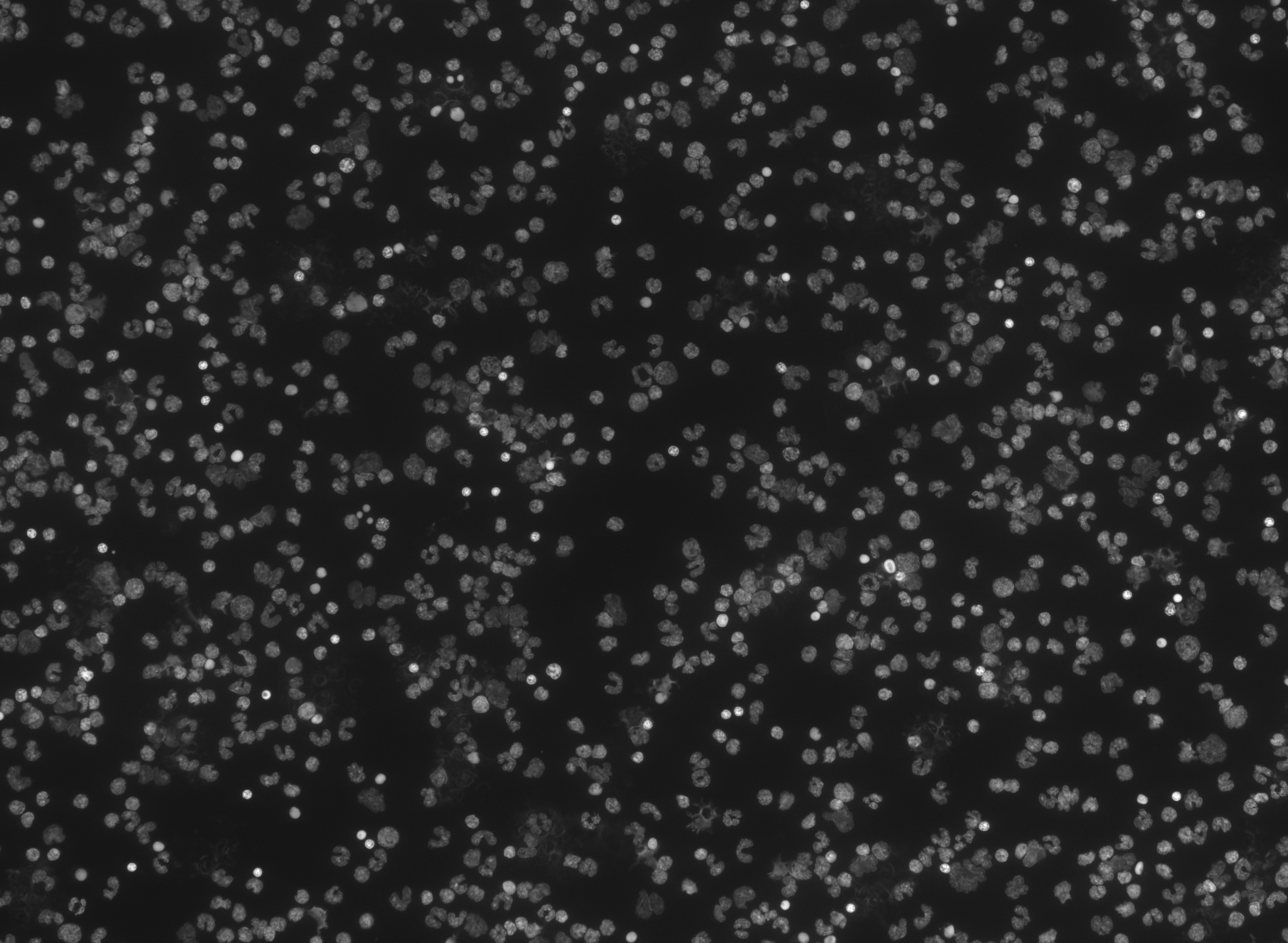 Cellpose results better online · Issue #547 · MouseLand/cellpose · GitHub