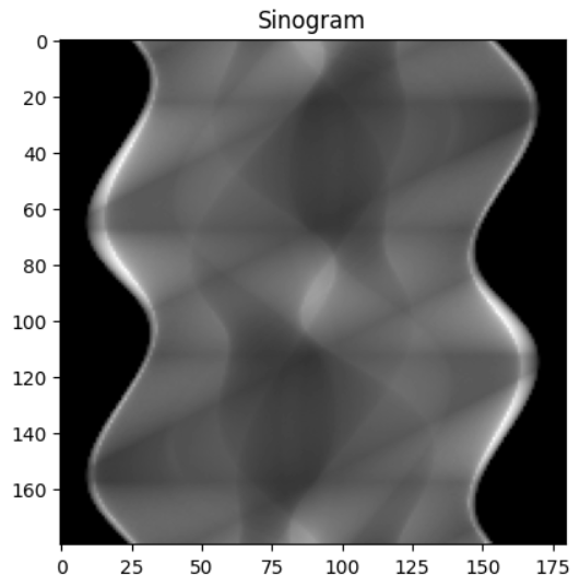 GitHub - HelenaMaslowska/Tomograph: Tomograph - Radon transform experiment.