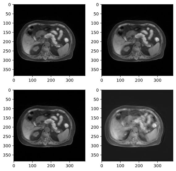 2D Tensor Support · Issue 143 · fepegar/torchio · GitHub