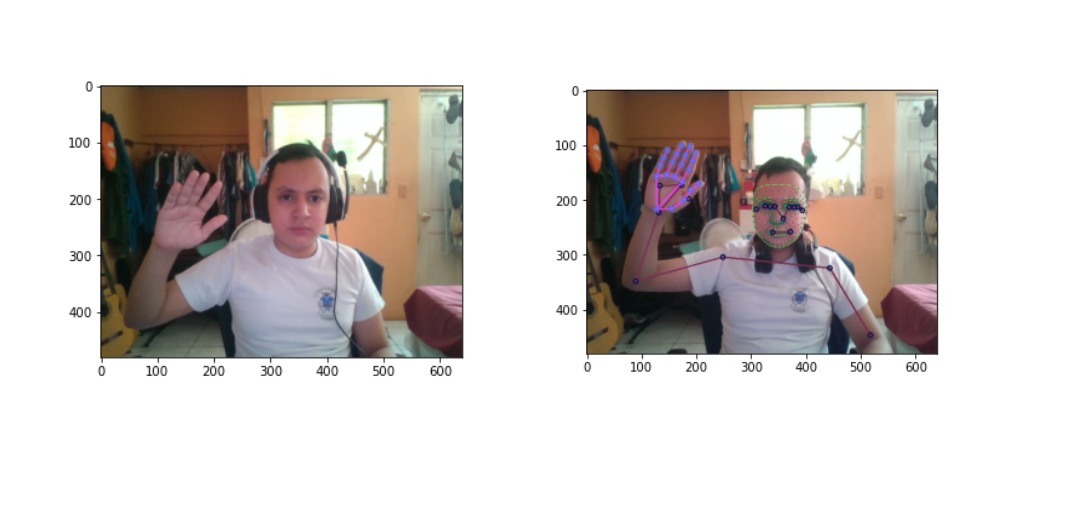 Dynamic Time Warping