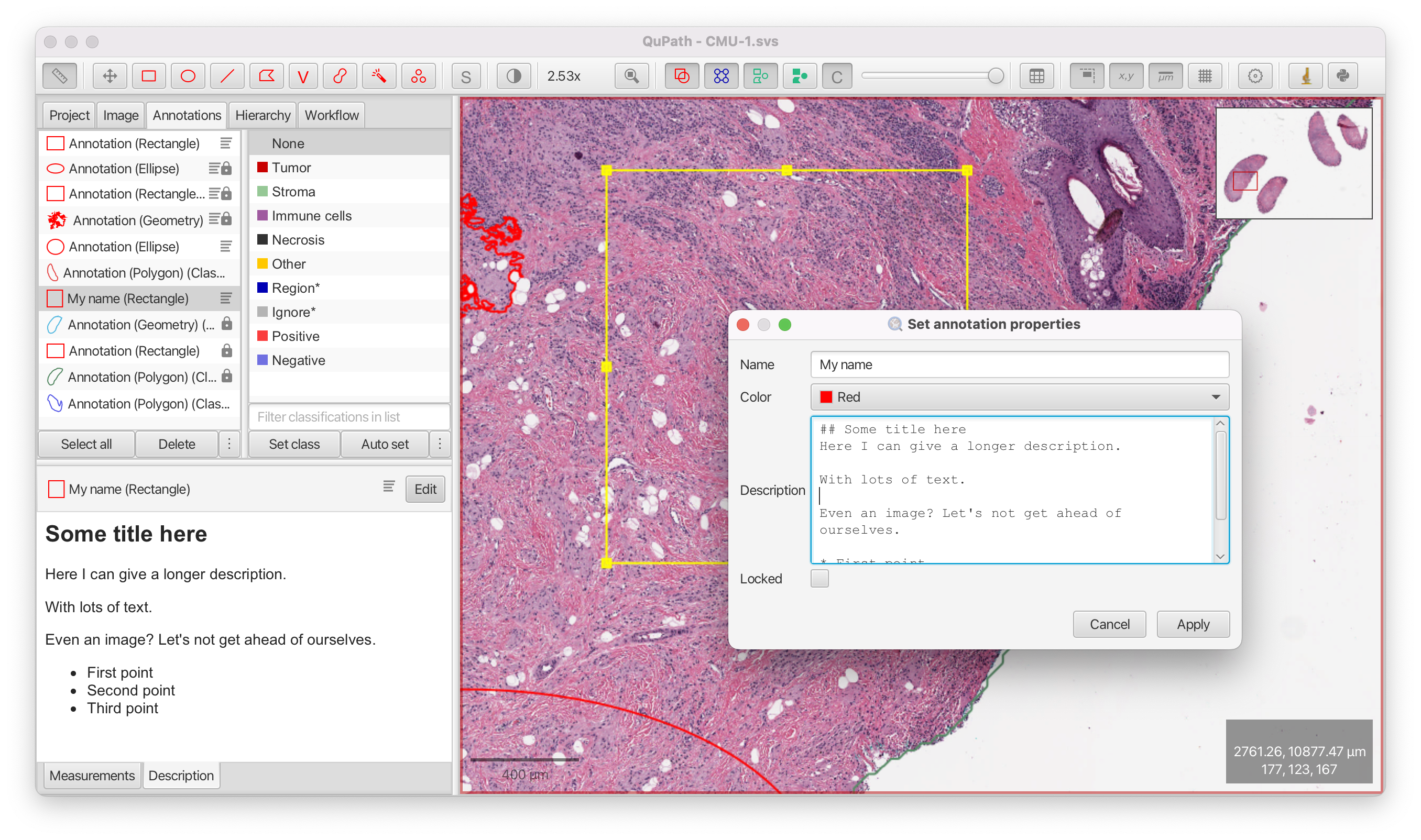 Add text/markdown to objects · Issue #1005 · qupath/qupath · GitHub