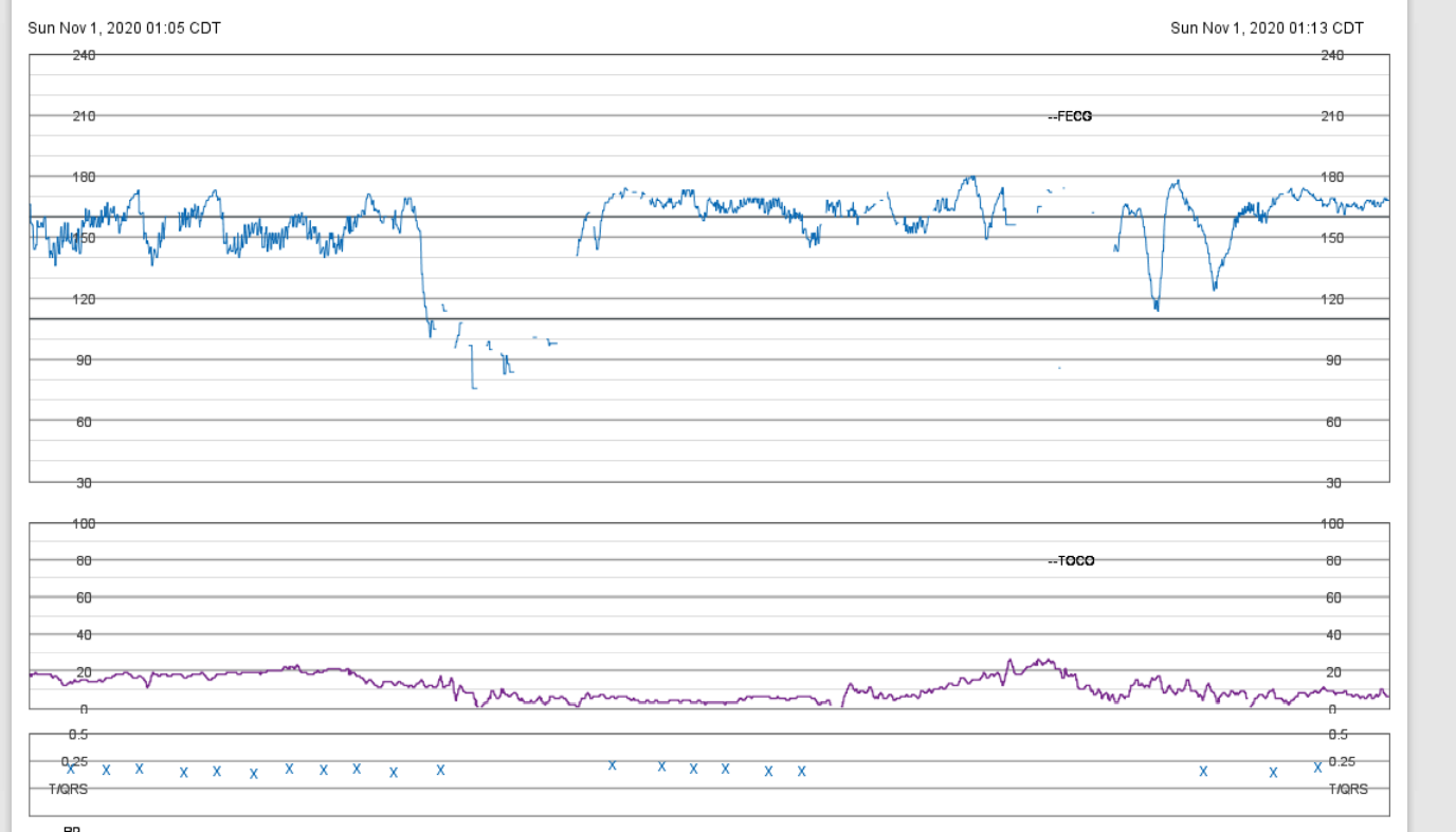 dates-are-set-to-incorrect-timezone-during-first-hour-of-fall-dst-event