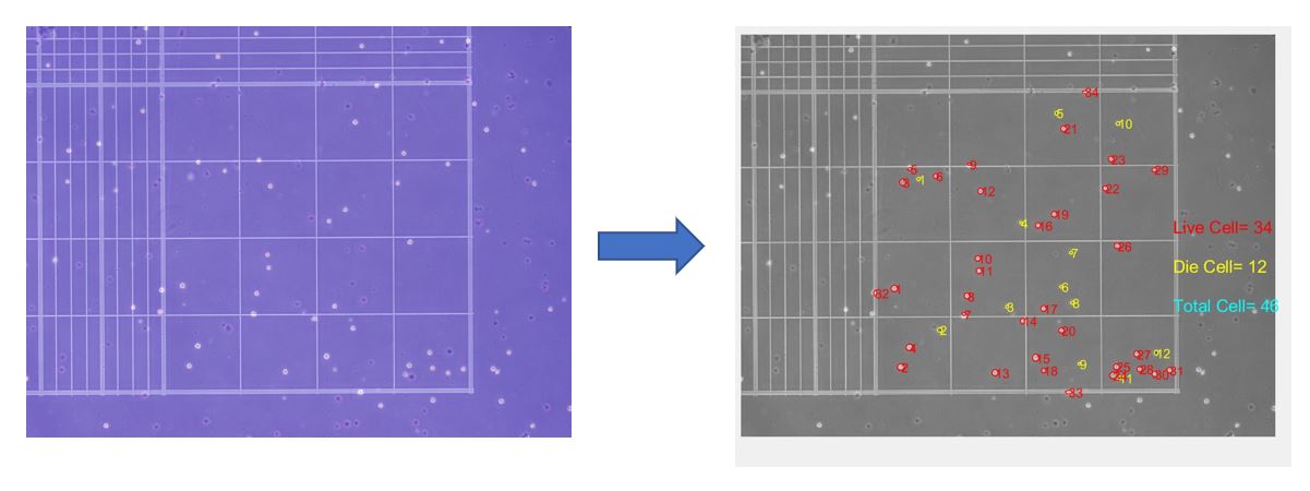 GitHub - ChungKee/Cell-recognization