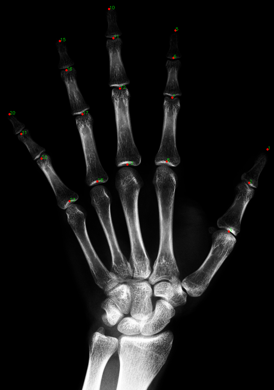 Hand Annotation X Ray GitHub - elmugrearturo/rxhands: Labeling of finger landmarks in hand ...