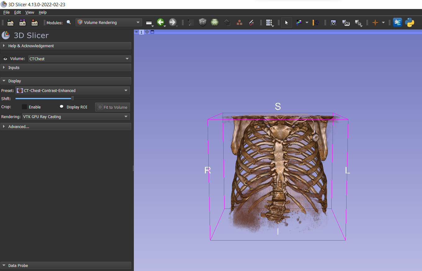 GitHub - ziyunxiao/SlicerVolumePlaneCut: Slicer Extension for Volume ...