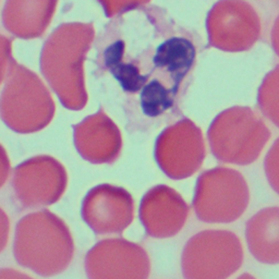 GitHub - BigDoot/BloodCellDetection: Classification of red and white ...