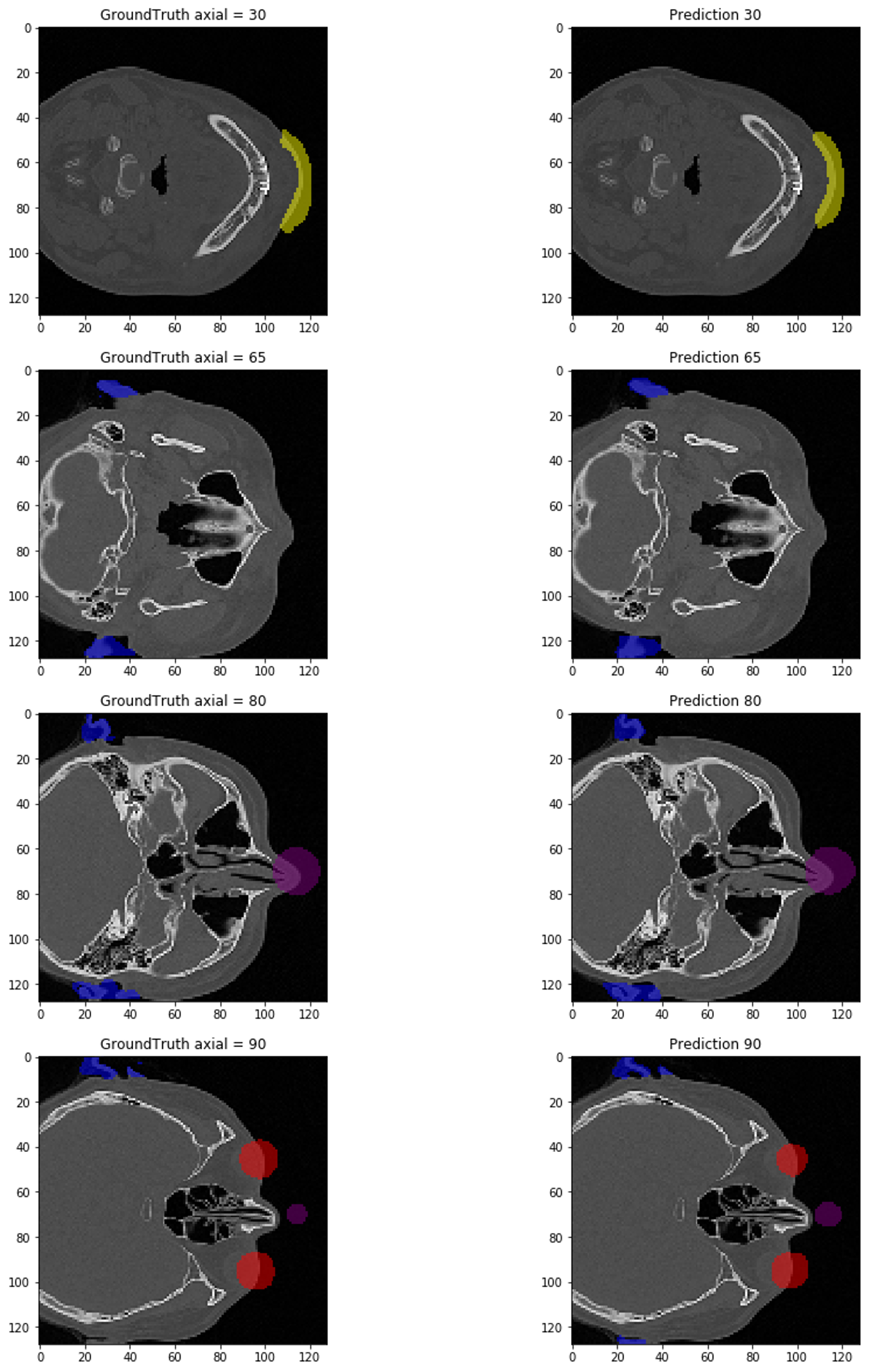 GitHub - yeonuk-Jeong/Defacer: Asan medical center medical image ...