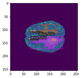 Using data augmentation results in large boxes than expected · Issue ...