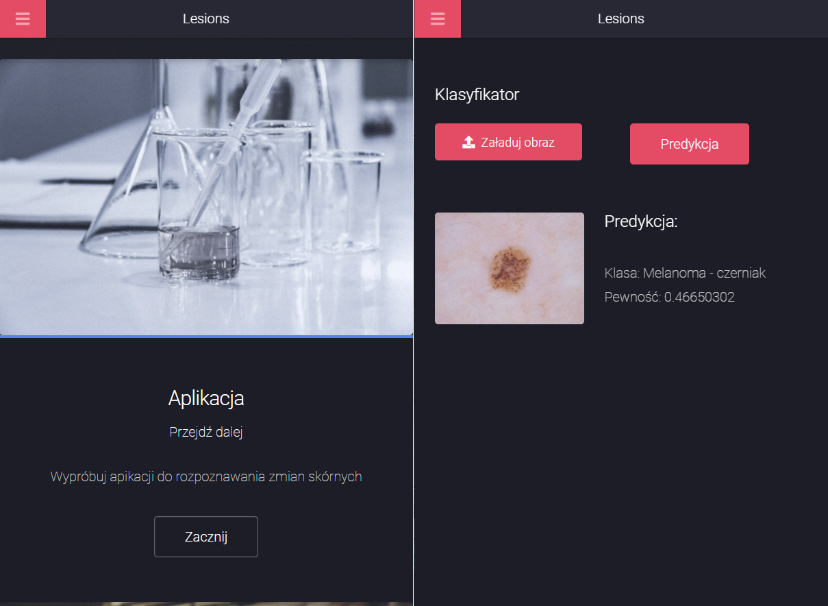 GitHub - piotrgitt/lesions