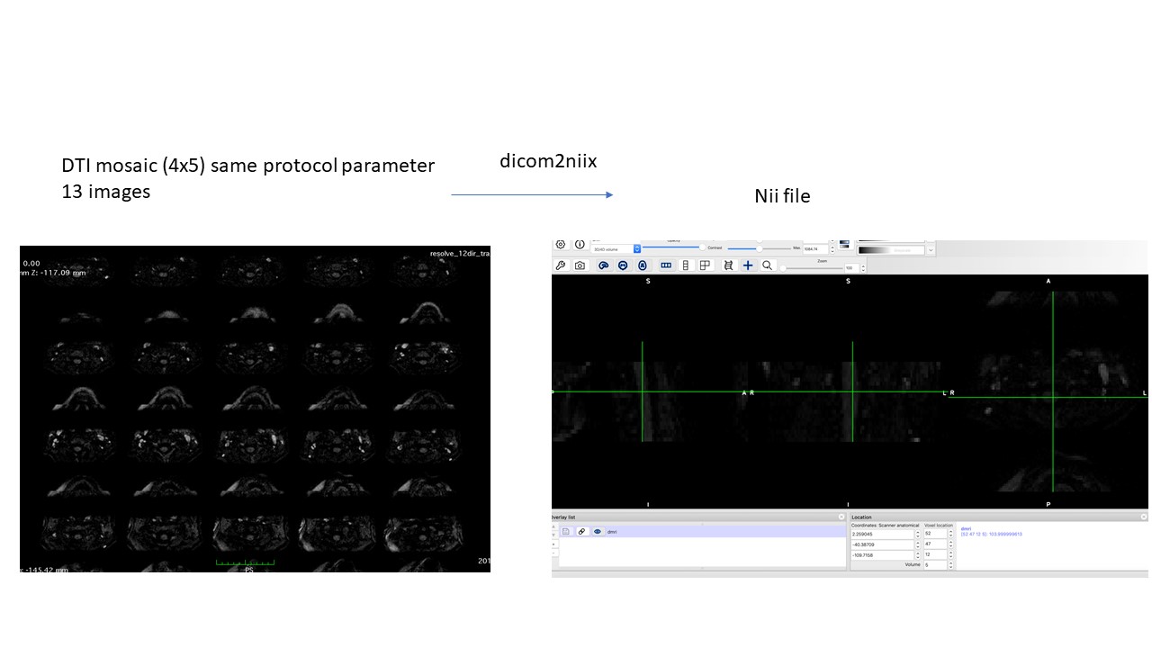 DTI dicom to nii probem · Issue #348 · rordenlab/dcm2niix · GitHub