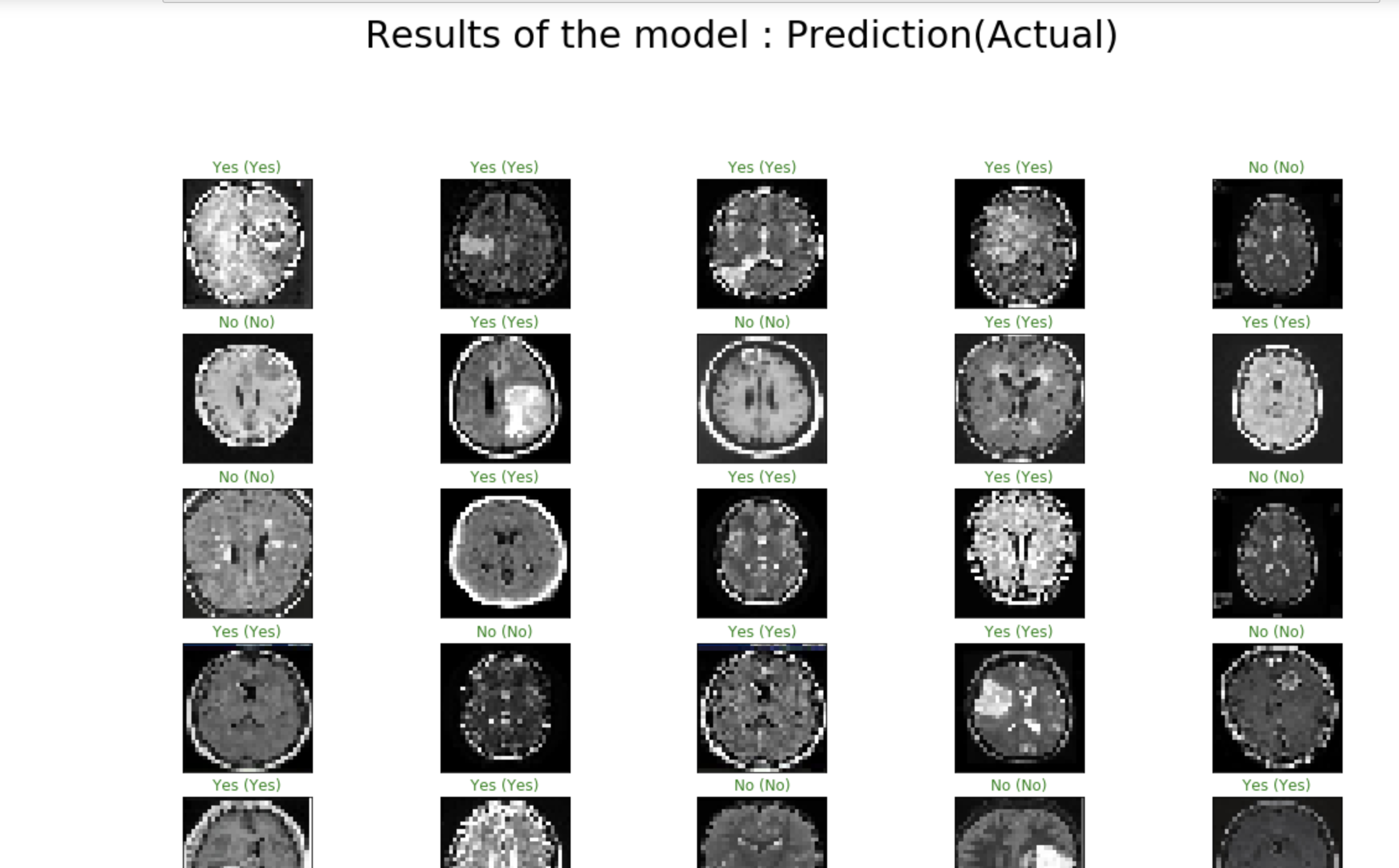 Mri Cnn GitHub - mohithchava/Brain-Tumor-Detection-CNN: Detecting Brain Tumor ...