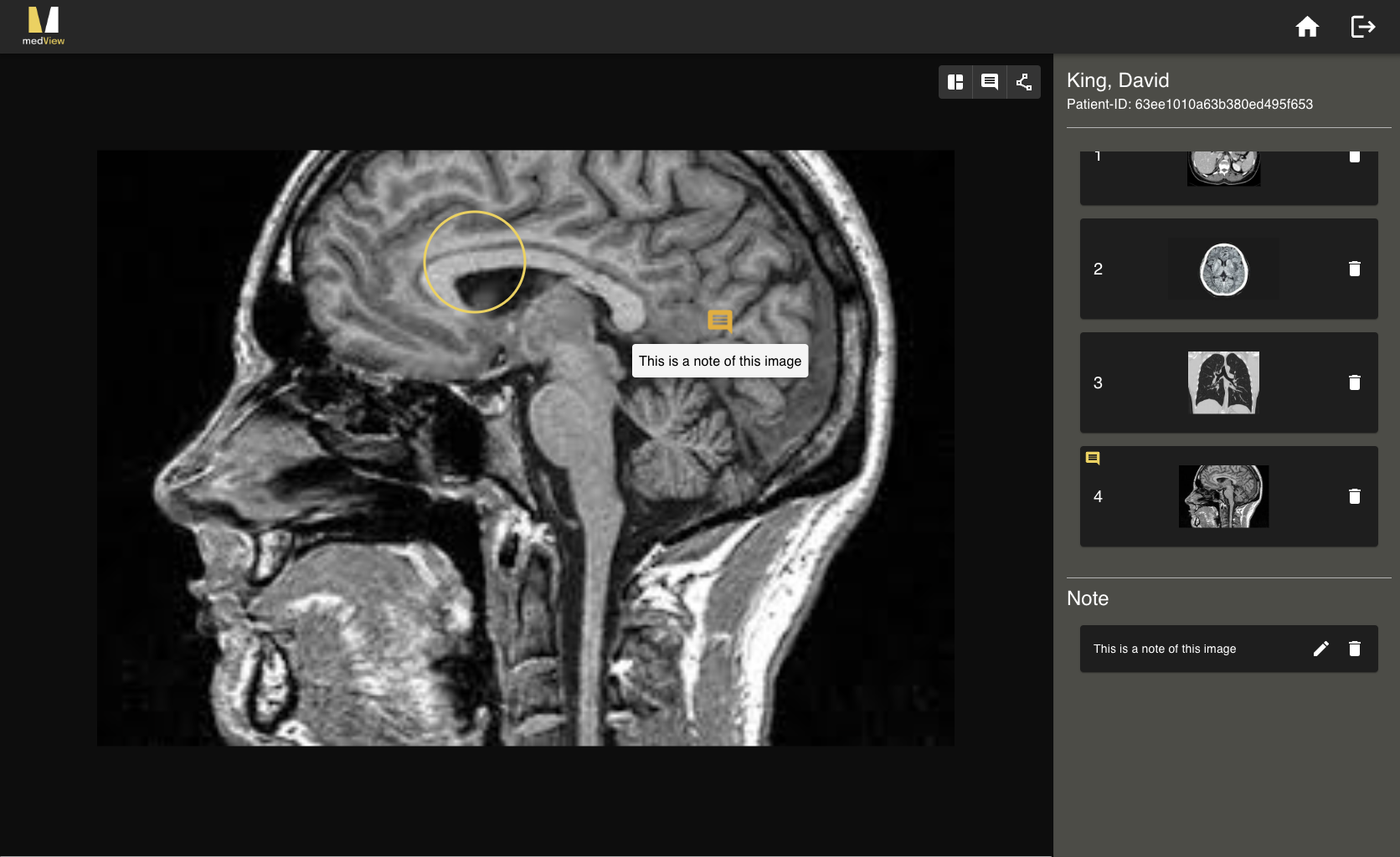 Medview GitHub - ThanhXuanDuong/capstone-project-medView: A medical image ...
