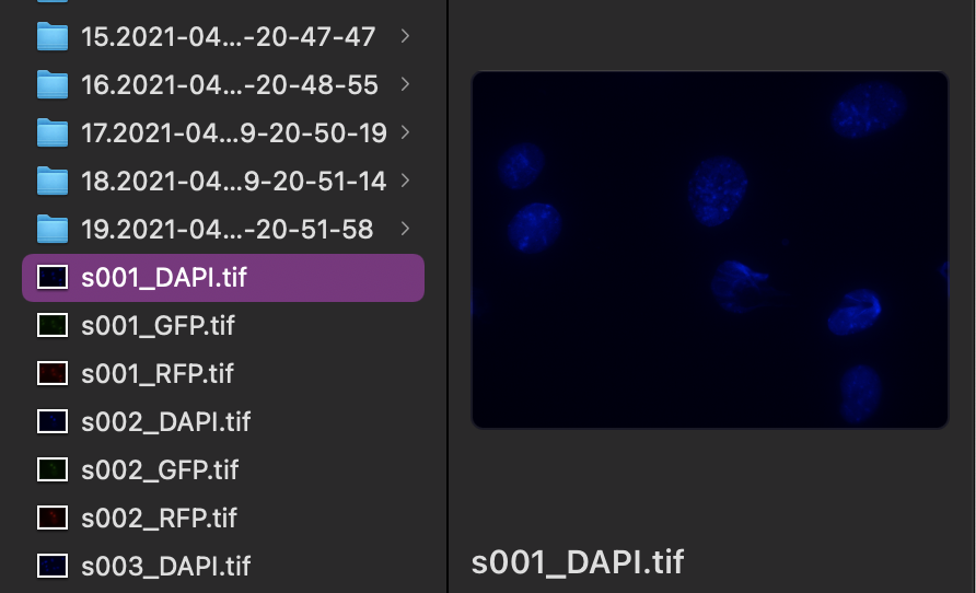 GitHub - breezyzhao/FISH-counting · GitHub