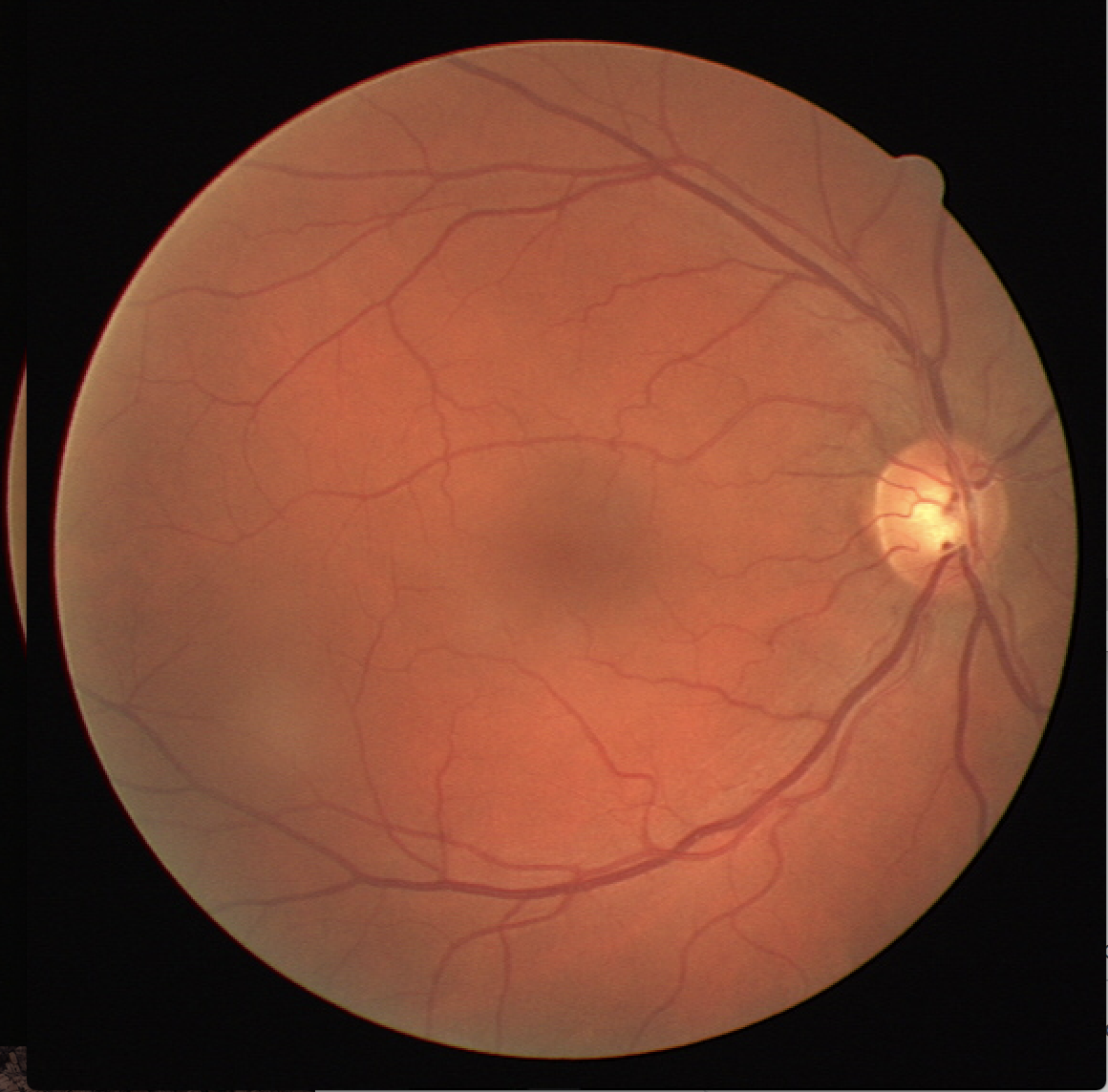 GitHub - krishnabairavi95/retina-segmentation-CNN-