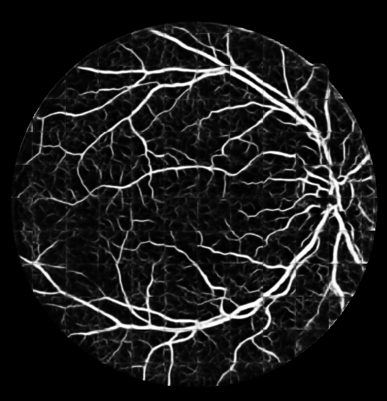 GitHub - krishnabairavi95/retina-segmentation-CNN-