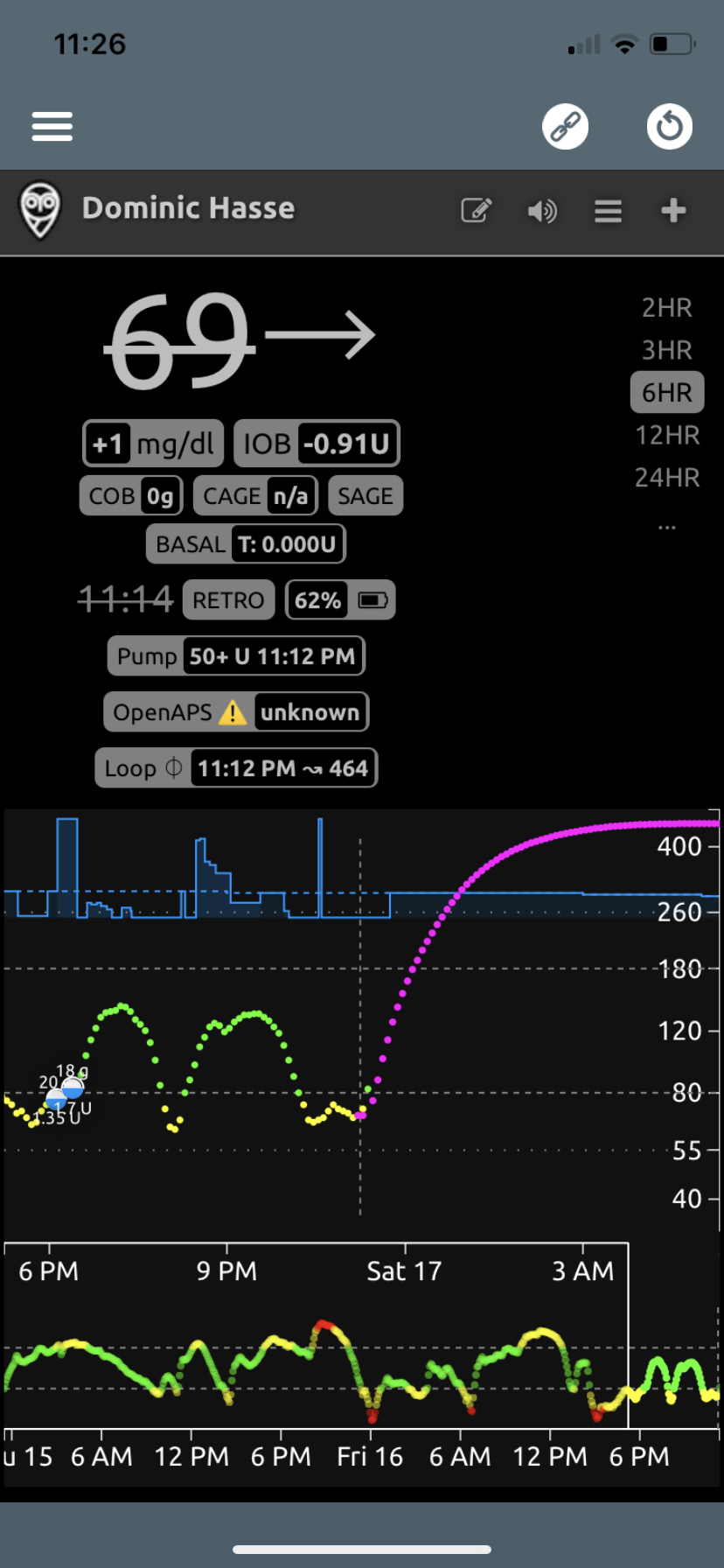 Change made to carb ratio caused abnormal/enormous inaccurate Carb