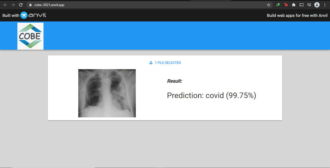 GitHub - safciezgi/Covid19-DeepLearning: A Deep Learning Web App ...
