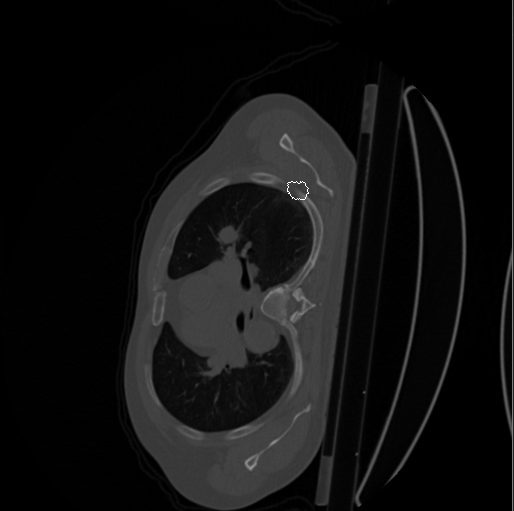 Masks not placed correctly after augmentation · Issue 713