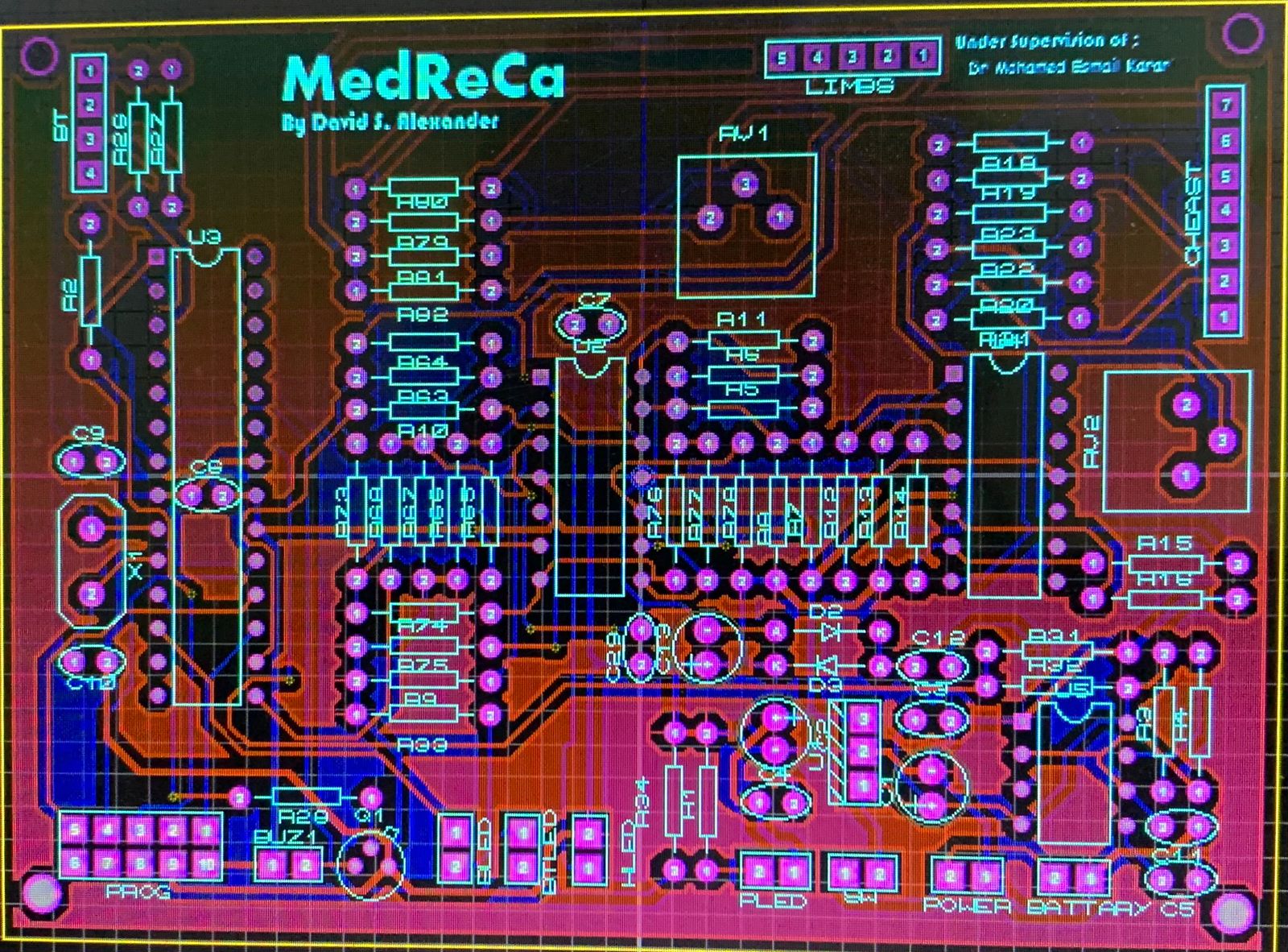 GitHub DavidSAlexander/ECGCalibrator A machine used in medical