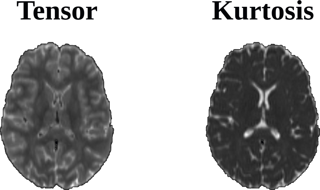 tensor_vs_kurtosis