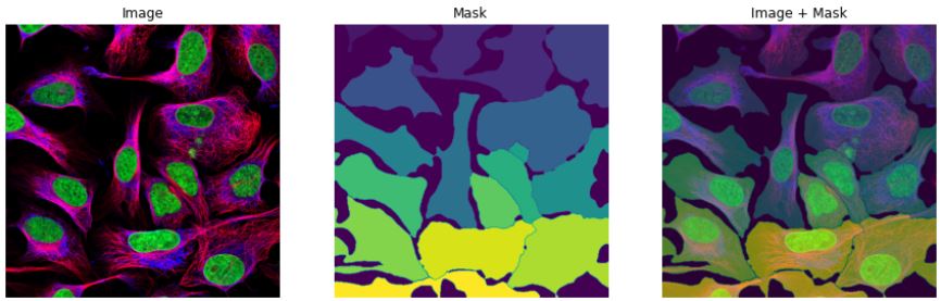 GitHub - cjf8899/Human-Protein-Atlas-Competition-in-Kaggle: :fire:Find ...