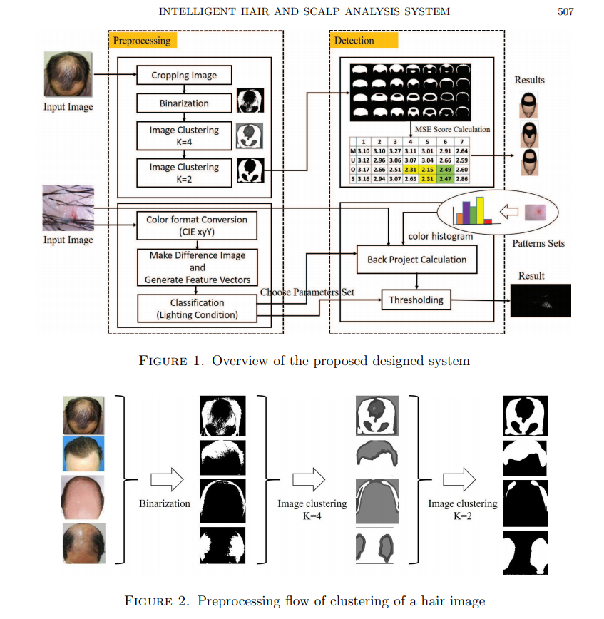 GitHub macarize/Intelligent_hair_analysis_system Diagnose a baldness