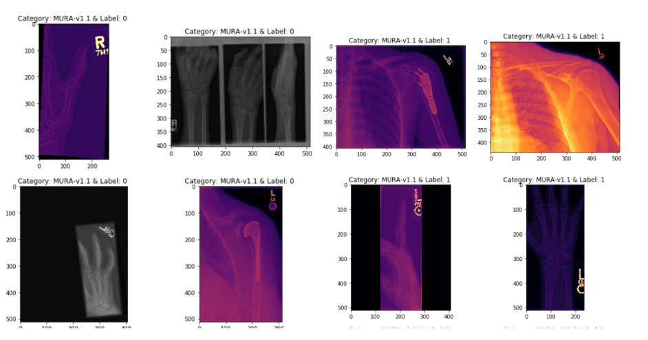 GitHub - Julio-M39/04-Abnormality_Detection · GitHub