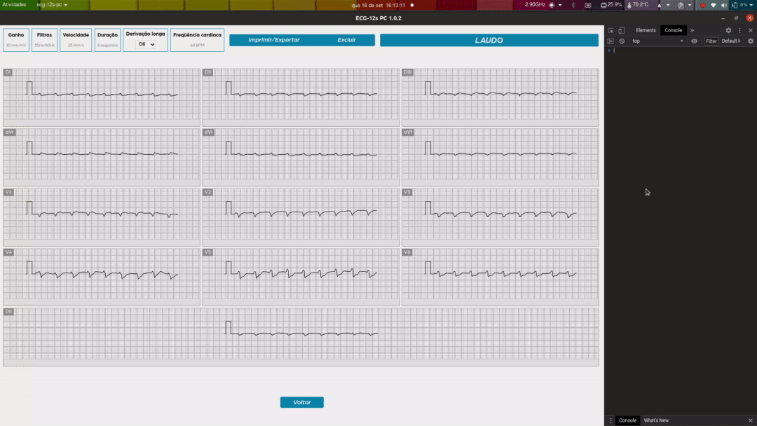 electron-issue