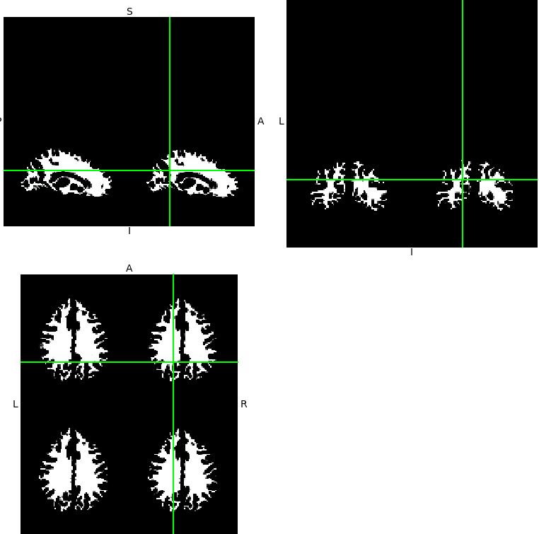 bad image reading when data type is float 64 · Issue #591 · TorchIO ...