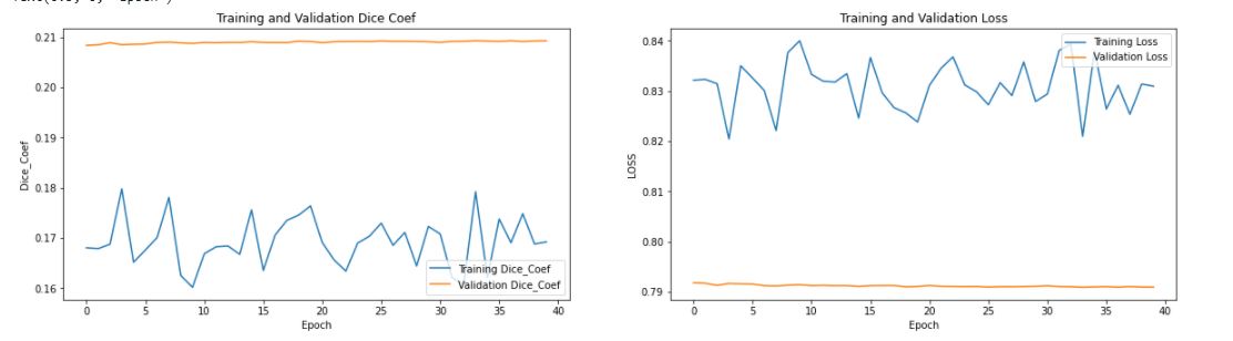 Segment_Unet++