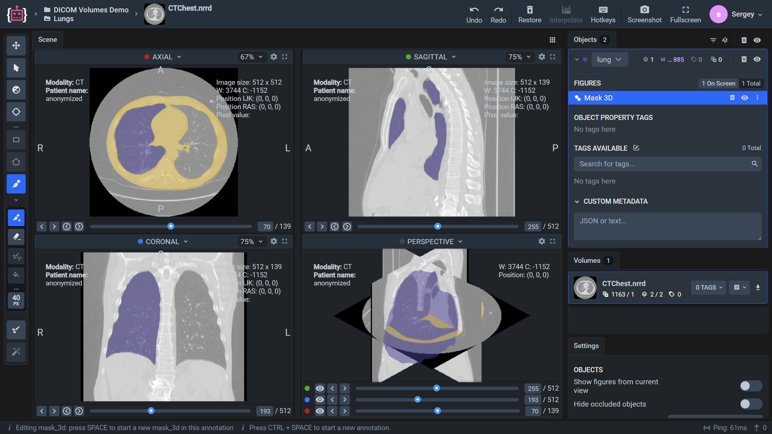 GitHub - supervisely-ecosystem/dicom-spatial-figures