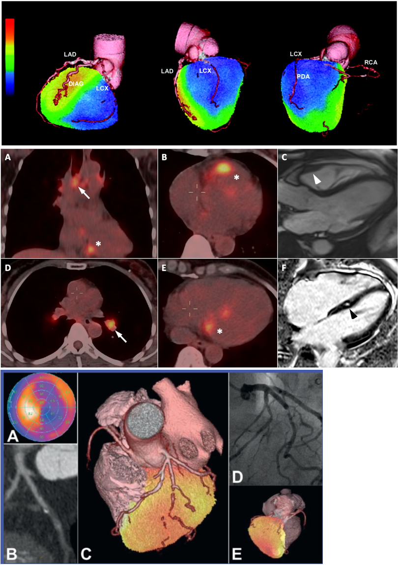 GitHub - SteveJustin1963/tec-PET-scan