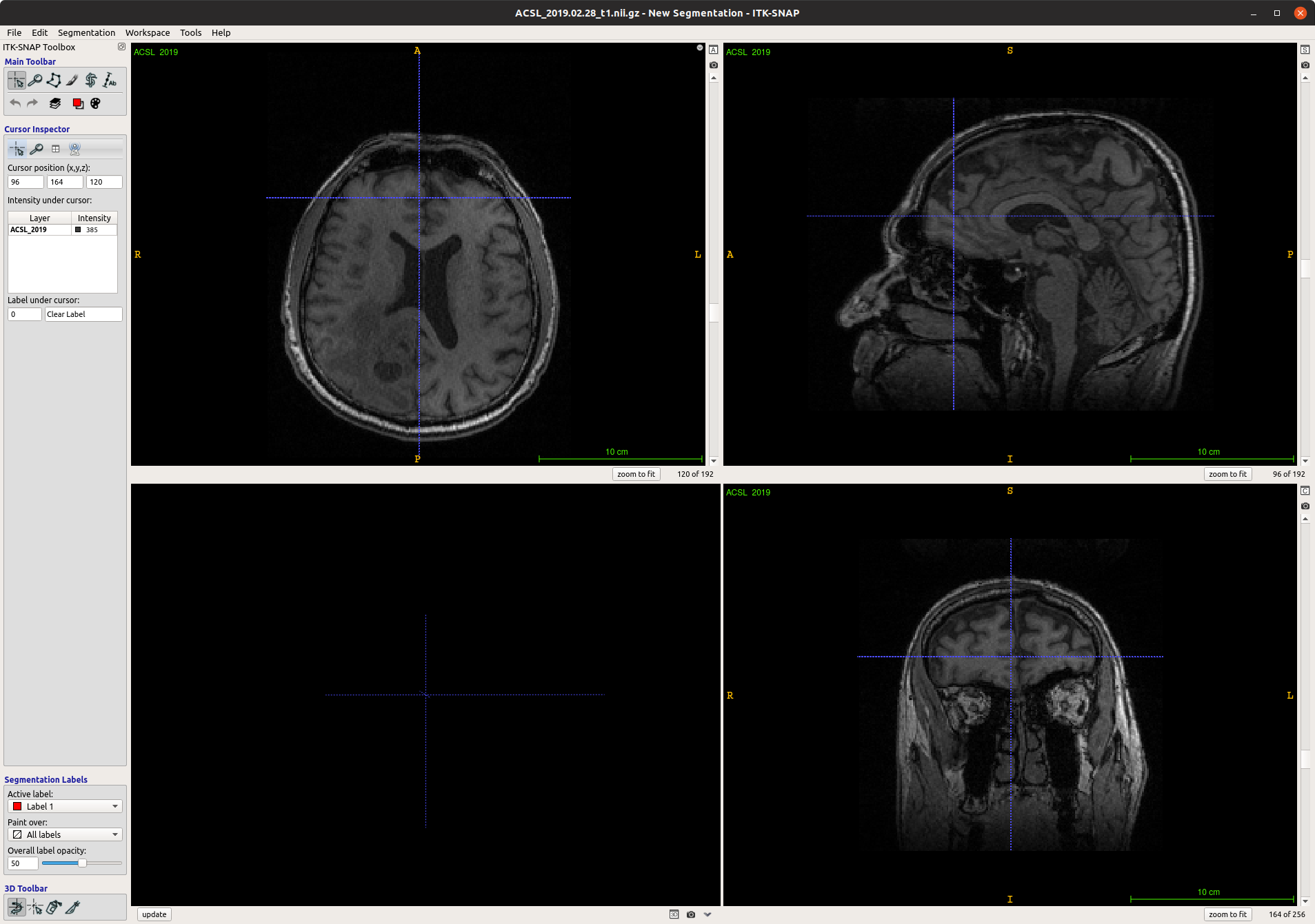 ACSL_2_original_nifti