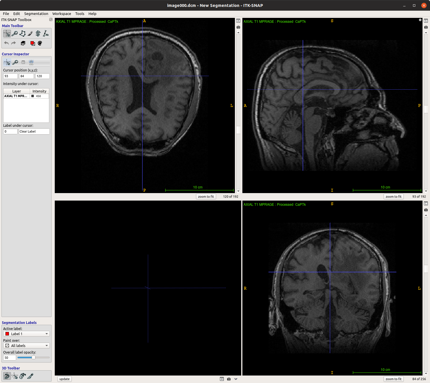 ACSL_3_convertbacktodcm