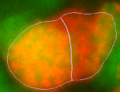 Edit ROI in 3D? · Issue #609 · MouseLand/cellpose · GitHub