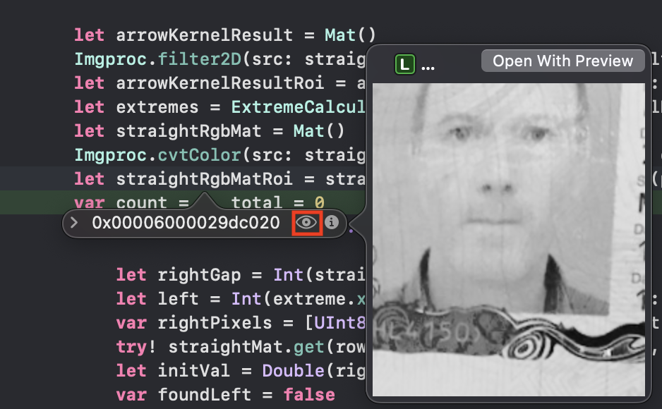 ImageView